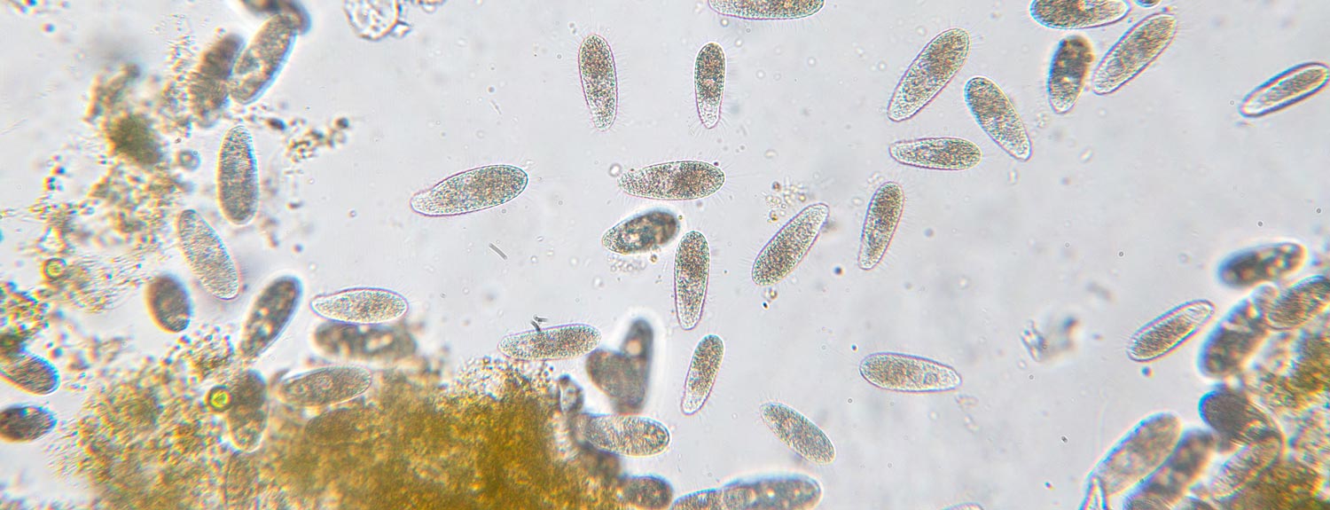Closeup of bacteria